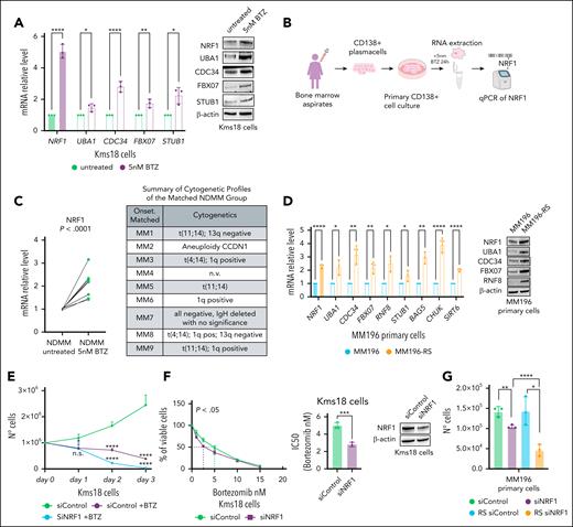 NRF1 upregulation mediates adaptive resistance to proteasome inhibition. (A) qRT-PCR of the indicated genes (left) and WB analysis with the indicated antibodies (right) of Kms18 MM cells untreated or treated with 5 nM BTZ for 48 hours. qRT-PCR data are presented as the mean ± SD of 3 independent experiments, with values normalized to actin expression. Error bars represent the standard error of 3 separate experiments. Student t test (∗P < .05; ∗∗P < .01; ∗∗∗∗P < .001). (B) Schematic representation of the experimental setup for detecting NRF1 transcript levels in NDMM samples treated and untreated with BTZ. PCs (CD138+) isolated from a cohort of 9 patients with NDMM were maintained in culture for 24 hours and then untreated or treated with 5 nM BTZ for 24 hours. (C) qRT-PCR analysis of NRF1 expression levels in the cohort described in panel B. Values were normalized to actin expression. Student t test ∗∗∗∗P < .001 (left). Table showing the cytogenetic profiles detected at the time of the patient's diagnosis (right). (D) qRT-PCR analysis of the indicated genes in MM196 primary and resistant to BTZ (MM196-RS) cell lines. Data are presented as mean ± SD of 3 independent experiments with values normalized to actin expression. Error bars represent the SD. Student t test ∗P < .05; ∗∗P < .01; ∗∗∗∗P < .001 (left). WB analysis of TCE from primary and adapted MM196 cells to BTZ for the indicated antibodies (right). (E) Proliferation analysis at the indicated points of Kms18 MM cell transiently transfected with siControl and siNRF1 and treated or not with 5 nM BTZ. Data are presented as the mean ± SD of 3 independent experiments and error bars represent the SD. Student t test ∗P < .05; ∗∗∗∗P < .001. (F) Kms18 MM cells transiently transfected with siControl or siNRF1 were treated with increasing BTZ concentrations. Cell viability and IC50 were measured after 48 hours. Values were calculated from the fitted curves. Data are presented as the mean ± SD of 3 independent experiments and error bars represent the SD. Student t test ∗P < .05; ∗∗∗P < .005. Bar plot (middle) showing IC50 levels obtained in the figure on the left. WB analysis (right) of NRF1 protein levels upon siNRF1. (G) Proliferation assay of primary MM196 and resistant MM196-RS cell lines transiently transfected with siControl or siNRF1. Data are presented as mean ± SD of 3 independent experiments and error bars represent the SD. Student t test ∗P < .05; ∗∗P < .01; ∗∗∗∗P < .001. IC50, half maximal inhibitory concentration; n.s., not significant.