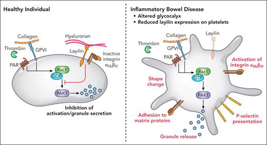 In healthy conditions, layilin colocalizes with integrin αIIbβ3, detects HA of the glycocalyx, and mitigates Rac1/p21–activated kinase 1 (PAK-1) signaling in platelets, preventing activation and granule secretion. Under inflammatory conditions in patients with IBD with altered vascular glycocalyx and reduced layilin expression, platelets react to low concentrations of thrombin and collagen with shape change, P-selectin presentation, increased integrin αIIbβ3 affinity to matrix proteins, and granule secretion. Professional illustration by Patrick Lane, ScEYEnce Studios.