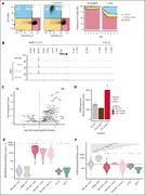 CEBPA repression by MECOM/CTBP complex is an essential event in 3q26-rearranged AML. (A) Flow cytometric analysis of MUTZ3 cells transduced with a lentiviral dox-inducible CEBPA construct. Cells were treated with dox (1 μg/mL) for 7 days and stained with CD15-APC and CD34-PeCy7 (day 7 shown). Flow cytometric analysis from panel A, shown at days 2 to 7. Frequencies reported as percentages of single cells, based on the gates shown in panel B (days indicated). (B) ChIP-sequencing of MECOM and CTBP2 in MUTZ3 cells. CTBP2 tracks are in MUTZ3 cells, MUTZ3+ 4× PLASS and MUTZ3+ 4× PLDLS. Data are reads per kilobase per million normalized; hg19. 4× PLASS serves as a negative control and does not outcompete CTBP2 binding to MECOM. (C) Volcano plot of DEseq analysis of 4 dox-treated pCW-4× PLDLS MUTZ3 clones vs untreated (72 hours; design: ∼ clone + condition). The horizontal line indicates a significance level of adjusted P value <.05. Arrows indicate genes outside axis limits. The top 40 consistently changed genes between panels A,C are labeled (total overlapping: downregulated, 22; and upregulated, 70). (D) Bar plot of DESeq2-normalized counts for CEBPA (experiment as shown in panel A). (E) Normalized MECOM expression (RNA-seq) across a cohort of patients with AML. Samples were grouped according to a set of known molecular subtypes (CEBPA bZIP, 3q26/MECOM, inv(16), and t(8;21)) and MECOM expression. MECOM+ patients without 3q26/MECOM rearrangement were further subsetted based on the presence or absence 11q23/KMT2A rearrangement. All other subtypes are contained in the “other” category. No statistical test is shown in this plot because MECOM levels were used to define groups. (F) Normalized CEBPA expression in AML subtypes. In addition, a case with a complete CEBPA deletion and cases with CpG island methylator phenotype (characterized by a heavily methylated CEBPA promoter) were excluded from the analysis due to their complete lack of expression of CEBPA. Adjusted P values from DESeq2 are reported for indicated comparisons, and group sizes are indicated above each box plot. A dashed line indicates the median of the control group. dox, doxycycline; mb, megabases; no tx, no treatment.