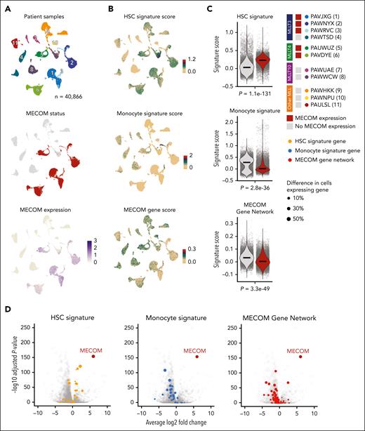 Direct MECOM gene network is repressed in primary leukemia cells. (A) UMAP of 40 866 cells derived from 11 patients with leukemias driven by MLLrs sequenced using scRNA-seq. UMAPs were colored from top to bottom by patient, whether MECOM is expressed, and MECOM expression counts per cell. (B) Same UMAPs as panel A and colored by the expression signatures of normal HSCs and normal monocytes derived from Lambo et al36 and MECOM-regulated genes identified to be activated after depletion of MECOM (Figure 2). (C) Quantification of the 3 signatures from panel B compared between MECOM-positive leukemias (n = 5) and MECOM-negative leukemias (n = 6). Comparisons were performed by randomly taking the average over 10 iterations of 1000 randomly sampled cells from both samples expressing MECOM and samples not expressing MECOM to avoid uninformative P values close to 0. Significance was calculated using 2-sided Wilcoxon signed-rank tests corrected for multiple testing using BH. (D) Differential expression of all analyzed genes (n = 28 113) between leukemias expressing MECOM and leukemias that did not express MECOM. Differential expression was performed using MAST using 10 iterations of 1000 randomly selected MECOM-positive cells and 1000 randomly selected MECOM-negative cells to prevent uninformative P values. BH corrected P values and log fold changes shown are the average of 10 iterations. BH, Benjamini-Hochberg; UMAP, uniform manifold approximation and projection.