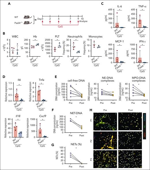 Improvement of systemic inflammation after NETosis ablation in a secondary HLH model and evaluation of reduced NETs formation after ruxolitinib treatment. (A) Experimental design of the secondary HLH model in which WT or Padi4–/– C57BL/6N mice were injected with CpG on days 0, 2, 4, 7, and 9 with analysis conducted on day 10 after first injection. (B) Changes in the WBC counts, Hb concentration, PLT counts, and frequencies of neutrophils, monocytes, and lymphocytes. (C) Quantified serum levels of IL-6, TNF-α, MCP-1, and IFN-γ. (D) Liver mRNA expression of Il6, Tnfa, Il18, and Cxcl9. The data points represent individual mice from a single experiment. (E) Quantification of circulating NETs, including cell-free DNA, MPO-DNA, and NE-DNA, from serum. (F) Quantification of NET-DNA concentration from neutrophils isolated from 3 patients with AOSD with MAS. (G) Quantification of the percentage of NETs (NE, MPO, and Hoechst-labeled neutrophils/total neutrophils). (H) Representative micrographs showing the immunostainings for the NET marker NE and MPO in neutrophils. ∗P < .05. Scale bar, 20 μm. MPO, myeloperoxidase; NE, neutrophil elastase.