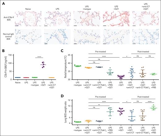 TRALI induced by anti-CD36 led to upregulation of C5b-9 in the lungs and could be inhibited by administration of anti-C7. (A) Immunohistochemical detection of C5b-9 (MAC) in mice lung tissue from untreated wild-type mice (naïve) compared with LPS pretreated and received afterward mAb GZ1 (0.4 mg/kg) or isotype control, and pretreated with anti-C7 before GZ1 (n = 5 in each group). Lung tissue sections were stained with rabbit anti-C5b-9 (top panel) or normal rabbit IgG (normal IgG control, bottom panel), and images were taken at ×80 original magnification. Representative images from each indicated group are shown. Scale bars, 25 μm. (B) C5b-9 concentration in BALF of the indicated mouse groups were measured by enzyme-linked immunosorbent assay. In the prophylactic approach, anti-C7 (dose: 1 mg/200 μL in PBS; n = 5), or anti-C7 F(ab′)2 (dose: 1 mg/200 μL in PBS; n = 5) was administered before TRALI induction with mAb GZ1 (0.4 mg/kg). In the therapeutic approach, TRALI was first induced with mAb GZ1 (0.4 mg/kg), then mice were treated with anti-C7 (dose: 1 mg/200 μL in PBS; n = 10), or anti-C7 F(ab′)2 (dose: 1 mg/200 μL in PBS; n = 10) after TRALI. PBS was treated as a control. Rectal temperatures (C) and lung W/D weight ratios (D) were measured as described earlier. Statistical analysis was performed with 1-way analysis of variance with Bonferroni correction for multiple comparisons (B-D). Each dot represents 1 mouse and error bars represent the standard deviations. ∗∗∗∗P < .0001; ∗∗P < .01; ∗P < .05. ns, nonsignificant.