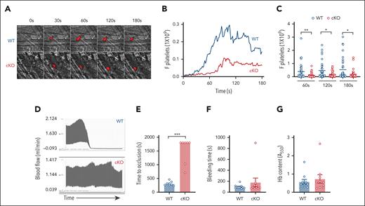 Platelet-targeted LRRC8A deletion impairs injury-induced arterial thrombosis, without prolonging tail bleeding. (A-C) Thrombosis in the cremasteric arterioles of Lrrc8afl/fl (WT) and Pf4-Cre;Lrrc8afl/fl (cKO) mice after laser-induced injury as observed by real-time confocal intravital microscopy (red, DyLight 649 anti-CD42C) (A) with median time course (B) and quantification of the fluorescent reporter at 60, 120, and 180 seconds after injury (n = 37 for both WT and cKO) (C). (D) Representative traces of arterial blood flow through the carotid artery of WT (top) and cKO (bottom) mice after FeCl3-induced injury. (E) Median time taken for the carotid artery of WT (n = 8) and cKO (n = 7) mice to occlude after FeCl3-induced injury. (F-G) Total bleeding time after tail tip amputation of WT (n = 10) and cKO (n = 10) mice (F), with corresponding Hb concentrations of red blood cell lysates collected during the assay (G). Data in panel C are represented as mean only, whereas data in panels B,E are represented as median. Data in panels F,G are represented as mean ± SEM. Statistical significance was determined by the Mann-Whitney U test for panels C,E, and by unpaired t test for panels F-G. ∗P < .05; ∗∗P < .01; ∗∗∗P < .001. Hb, hemoglobin.