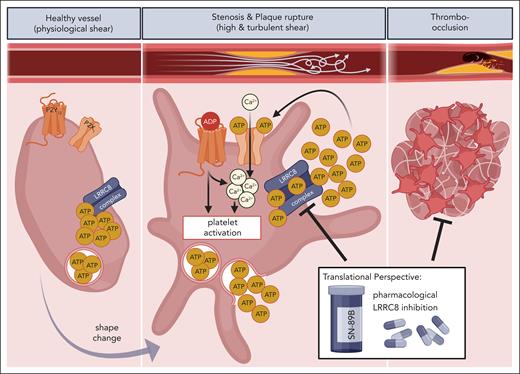 Schematic overview of LRRC8 activation and ATP-release with subsequent platelet activation, thrombo-occlusion, and clinical manifestation upon mechanical shear stress. Although in resting platelets the LRRC8 complex (VRAC) is inactive, mechanical shear stress at the sites of atherosclerotic stenosis or plaque rupture mediates LRRC8-dependent release of ATP with subsequent autocrine and paracrine platelet activation via purinergic (P2X1, P2Y12) signaling. Shear-induced platelet activation leads to clot formation and cardiovascular disorders, such as thrombosis, ischemic stroke, and myocardial thromboinflammation, which is potentially averted by pharmacologic LRRC8 inhibition. The figure was created with BioRender.com. Münzer P. (2025) https://biorender.com/72ra0hf.
