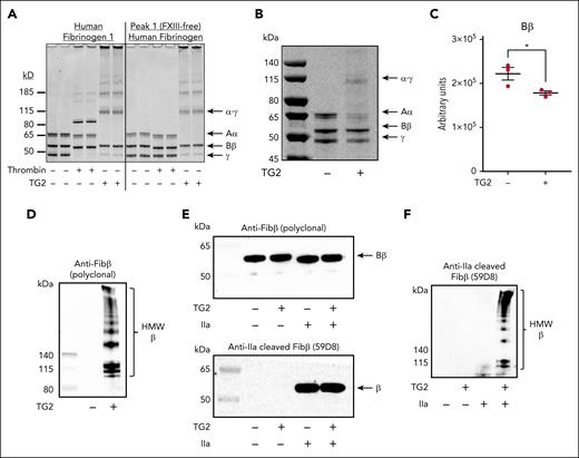 TG2 cross-links the fibrinogen β-chain to form HMW complexes. (A) Purified human fibrinogen (FIB1) and FXIII-free fibrinogen (peak 1) were incubated with thrombin (ie, to initiate fibrin polymer formation and FXIII-mediated cross-linking) or recombinant human TG2, as described previously.14 Reduced samples were resolved using sodium dodecyl sulfate–polyacrylamide gel electrophoresis (SDS-PAGE), and total protein was visualized with Coomassie Blue. (B) FIB1 (2 mg/mL) was cross-linked by TG2 (25 μg/mL), and reduced samples were resolved using SDS-PAGE and visualized with SimplyBlue. A representative gel of at least 3 independent experiments is shown. (C) Fibrinogen β-chain was quantified using densitometry. (D) Representative western blot for fibrinogen β-chain shows HMW cross-linked β-chain in fibrinogen cross-linked by TG2. (E) Thrombin (1 U/mL) or TG2 (25 μg/mL) was added to FIB1 (2 mg/mL). Representative western blots show fibrinogen β-chain detected using western blotting with the polyclonal anti-fibrinogen β-chain antibody (top) or monoclonal anti-fibrin β-chain (59D8) antibody (bottom). (F) Representative western blots show HMW fibrinogen β-chain in fibrinogen cross-linked by TG2 detected using western blotting with the anti-fibrin β-chain (58D8) antibody. For panels D-F, membranes were cut and probed with distinct primary antibody concentrations to resolve β-chain and HMW cross-linked β-chain.