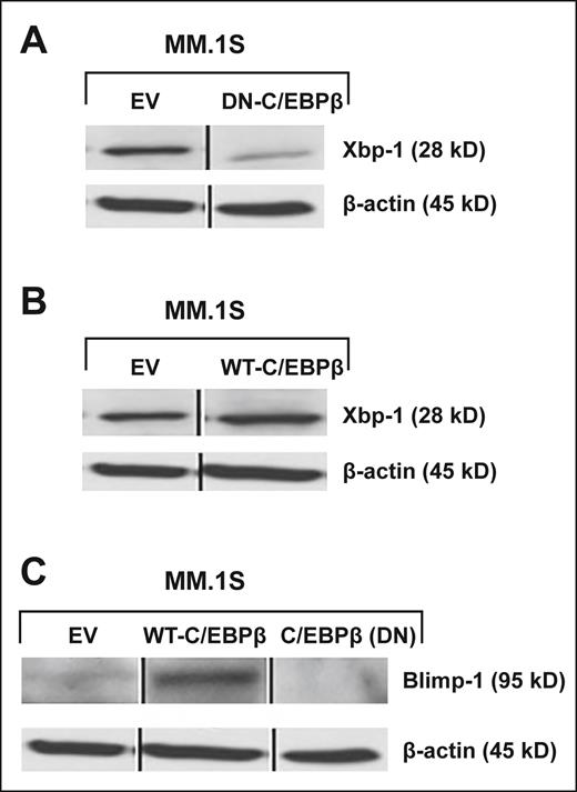 C/EBPβ regulates IRF4-dependent transcription factors such as XBP1 and BLIMP1. MM cells were transfected with EV, (A) DN-C/EBPβ, or (B) WT-C/EBPβ. Transfected cells were selected for 10 days by G418 (500 μg/mL). The selected cells were analyzed for expression of XBP1 by Western blotting with the anti-XBP1 antibody. (C) EV- and WT-C/EBPβ–transfected and selected cells were analyzed for the protein expression of BLIMP1. β-Actin was used as a loading control. Vertical lines have been inserted to indicate a repositioned gel lane.