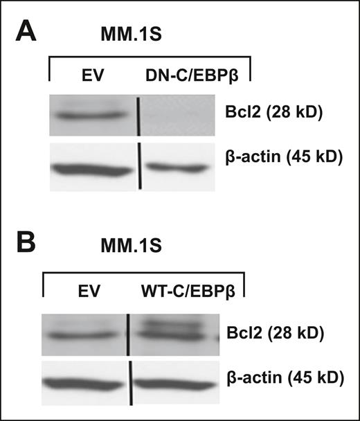 BCL2 is regulated by C/EBPβ. MM cells were transfected with EV, (A) DN-C/EBPβ, or (B) WT-C/EBPβ. Transfected cells were selected for 10 days with G418 (500 μg/mL). Lysates of transfected cells were subjected to Western blotting using anti-BCL2 antibody. β-Actin was used as a loading control. Vertical lines have been inserted to indicate a repositioned gel lane.