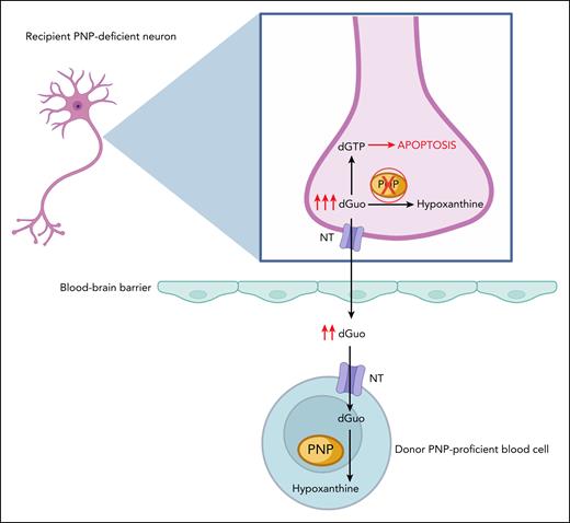 “Cross-correction” of PNP deficiency in neuronal cells after allogeneic HCT. In the recipient’s PNP-deficient neurons, the absence of functional PNP enzyme prevents the phosphorolysis of substrates such as deoxyguanosine (dGuo) into hypoxanthine, leading to accumulation of dGTP. This disrupts the cell’s metabolism and leads to the cell’s apoptosis. Excess dGuo can also exit the cell through transmembrane NT. After transplantation, excess dGuo is taken up by the donor PNP-proficient blood cell across the blood-brain barrier, following the concentration gradient of dGuo, where it can be further metabolized, eventually leading to the restoration of purine metabolism in the neuron. dGTP, deoxyguanosine triphosphate; NT, nucleoside transporters. Figure created with BioRender.com. Grunebaum E. (2025) https://app.biorender.com/illustrations/689a34dde8409e308ef5ce82.