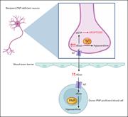 “Cross-correction” of PNP deficiency in neuronal cells after allogeneic HCT. In the recipient’s PNP-deficient neurons, the absence of functional PNP enzyme prevents the phosphorolysis of substrates such as deoxyguanosine (dGuo) into hypoxanthine, leading to accumulation of dGTP. This disrupts the cell’s metabolism and leads to the cell’s apoptosis. Excess dGuo can also exit the cell through transmembrane NT. After transplantation, excess dGuo is taken up by the donor PNP-proficient blood cell across the blood-brain barrier, following the concentration gradient of dGuo, where it can be further metabolized, eventually leading to the restoration of purine metabolism in the neuron. dGTP, deoxyguanosine triphosphate; NT, nucleoside transporters. Figure created with BioRender.com. Grunebaum E. (2025) https://app.biorender.com/illustrations/689a34dde8409e308ef5ce82.