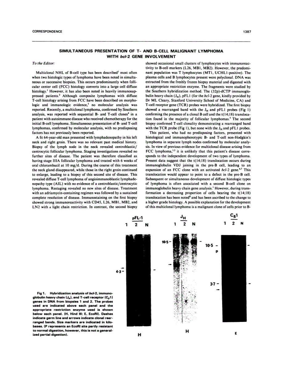 First page of Simultaneous presentation of T- and B-cell malignant lymphoma with bcl- 2 gene involvement