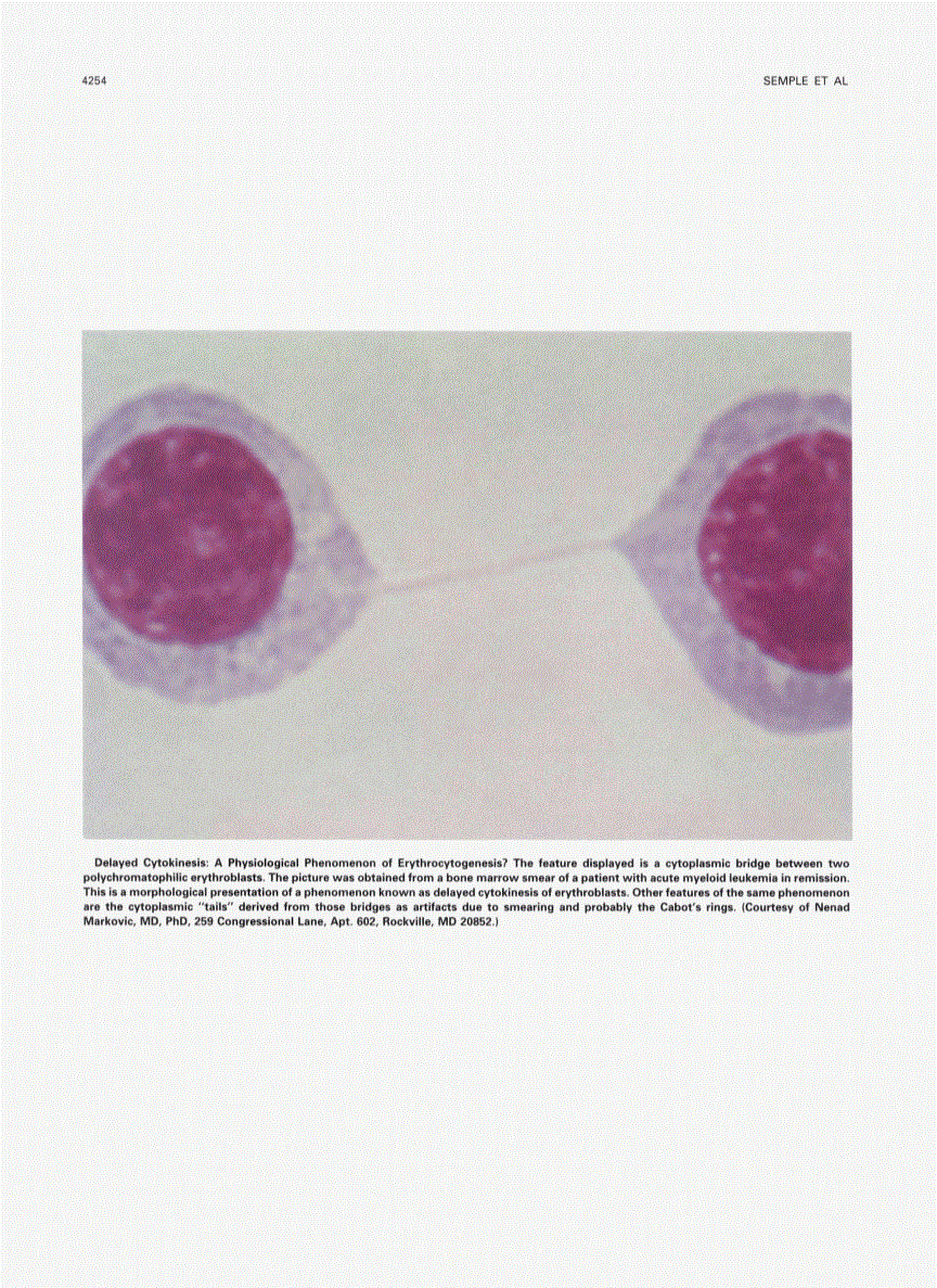 First page of Photograph