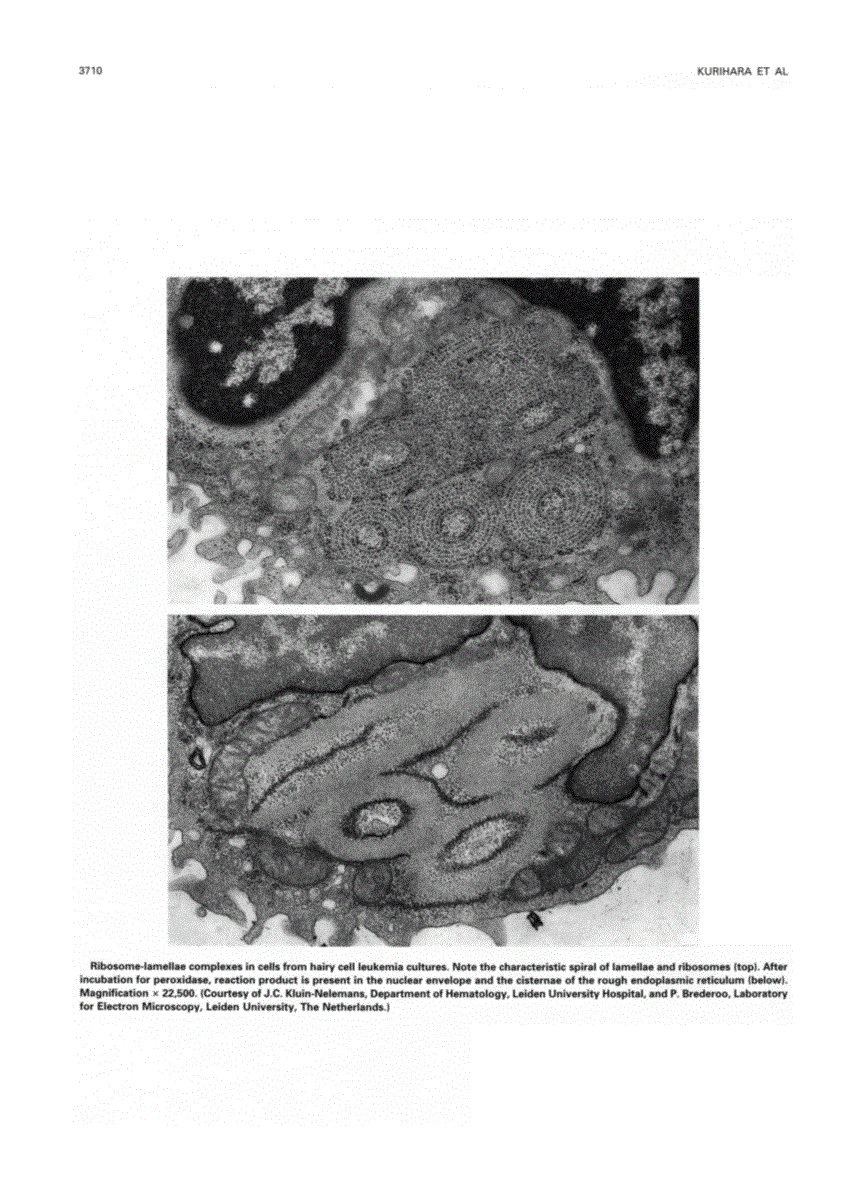 First page of Photograph