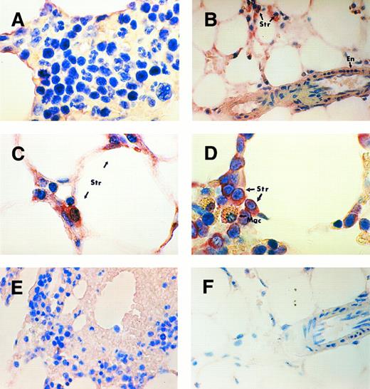 Fig. 1. TPO mRNA expression assessed by in situ hybridization on paraffin-embedded human BM trephine sections. BM of a subject with normal platelet count (A) showing weak signal, perhaps in stromal cells but negative staining in hematopoietic precursor cells. BM trephine of a patient with severe aplastic anemia (B and C) and a patient with ITP (D) showing strong hybridization signal in stromal cells (Str) and weak signal in endothelial cells (En). The macrophages (Mac) with golden brown hemosiderin granules show negative staining (D). BM of a subject with secondary thrombocytosis (E) showing no visible difference in staining intensity compared to that of the subject with a normal platelet count. Trephine section of aplastic anemia patient (F ) probed with plasmid vector pBR322 as a negative control. Original magnifications: (B, E, and F ) ×400; (A, C, and D) ×1,000.