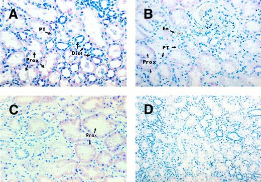 Fig. 2. Human kidney sections exhibiting TPO mRNA expression. Kidney sections of individuals with normal platelet counts, probed with TPO cDNA probe (A), TPO oligonucleotide probe (B), and the sense strand of the TPO mRNA as a negative control (D). Kidney section of a thrombocytopenic patient probed with TPO cDNA probe (C). Strong hybridization signal in proximal convoluted tubules (Prox) and less consistent staining in the distal convoluted tubules (Dist). Peritubular cells (PT) and endothelial cells (En) remain negative. Original magnifications: (A, B, and C) ×396; (D) ×240.