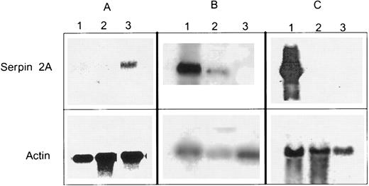 Fig. 4. Northern blots of RNAs isolated from (A) day 9 G/M differentiated FDCP-Mix cells before (lane 1), 30 minutes after (lane 2), and 4 hours after (lane 3) addition of 150 U/mL of IL-3, probed with labeled serpin 2A cDNA and α-actin. (B) Undifferentiated GM-CFC (lane 1), day 4 in vitro macrophage differentiated GM-CFC (lane 2), and day 4 in vitro granulocyte differentiated GM-CFC (lane 3) probed with labeled serpin 2A cDNA and α-actin. (C) Undifferentiated FDCP-Mix cells (lane 1), 15-day gestation fetal liver (lane 2), and adult liver (lane 3) probed with labelled serpin 2A cDNA and α-actin.