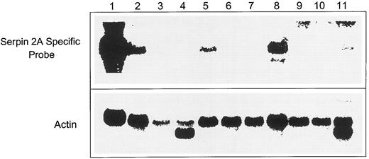 Fig. 5. Northern blot of RNAs isolated from adult murine organs. Lane 1, undifferentiated FDCP-Mix cells; lane 2, lung; lane 3, liver; lane 4, heart; lane 5, thymus; lane 6, small intestine; lane 7, bone marrow; lane 8, spleen; lane 9, kidney; lane 10, brain; and lane 11, testis probed with labeled 3′ specific serpin 2A cDNA fragment.