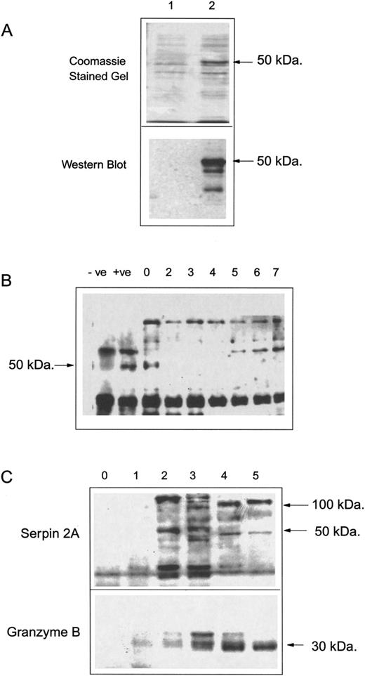 Fig. 7. SDS polyacrylamide gel electrophoresis showing (A) Coomassie brilliant blue stained 12% gel of proteins isolated from lane 1, noninduced culture of BL21DE3 plys S transformed with serpin 2A ORF cloned into the Pet 3A T7 RNA polymerase expression vector; lane 2, the same culture after 2 hours of induction at 37°C with 0.2 mmol/L IPTG and a Western immunoblot of a duplicate gel probed with the serpin 2A peptide antiserum. Detection was by ECL and the exposure time for the blot shown was 3 seconds. (B) Western immunoblot of proteins isolated from an FDCP-Mix G/M differentiation time course. The +ve control lane was made up of proteins isolated from the amphotropic retrovirus packaging cell line GP + envAm1213 that had been transfected with the serpin 2A ORF cloned into the high level retroviral expression vector M5. The −ve control lane was made up of proteins isolated from the wild type packaging cell line. This was incubated with the serpin 2A peptide antiserum with detection by peroxidase conjugated antiimmunoglobulin and ECL. Exposure times were typically between 1 and 2 minutes. (C) Western immunoblot of proteins isolated from Con A + Il-2 activation time course of primary splenocyte T cells. Lanes 0 to 5 represent the period of the activation in days. These were incubated with the serpin 2A antiserum and detection was by ECL with an exposure time of 1 minute.
