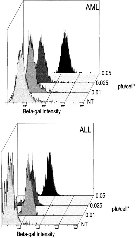 Fig. 6. High-efficiency transduction of myeloid and lymphoid leukemic cells with the DISC-HSV β-GAL vector. The x-axis denotes the intensity of β-GAL staining 48 hours after transduction with the DISC-HSV vector at various pfu/cell. Blast cell populations are defined by appropriate gating using forward-versus-side scatter. Representative results of one AML and one ALL patient are shown from the patients presented in Table 1. *pfu/cell:- for details of titering see Materials and Methods.