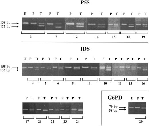 Fig. 1. RT-PCR analysis expression of P55, IDS, and G6PD genes in patients with monoclonal hematopoiesis. RNA of heterozygous patients was submitted to RT-PCR. Amplified products were digested with Hha I, HpaII and Pvu I, respectively, and analyzed by gel electrophoresis and ethidium bromide staining. Three to 24 correspond to the patient numbers in Table 4. U, undigested PCR products; P, platelets; T, T lymphocytes. Arrows indicate the size of the fragments in base pairs.