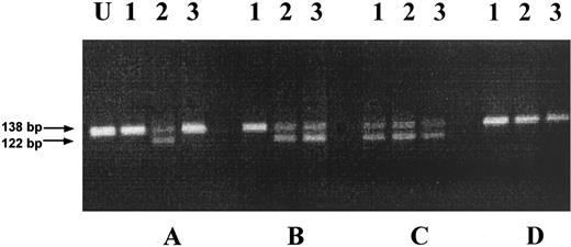 Fig. 2. RT-PCR analysis of allelic expression of the P55 gene. RNA of heterozygous patients was submitted to RT-PCR. Amplified products were digested with Hha I and analyzed by gel electrophoresis and ethidium bromide staining. (A) Illustrates the results obtained from a patient with monoclonal hematopoiesis in platelets and granulocytes; (B) patient with monoclonal hematopoiesis only in platelets; (C) patient with polyclonal hematopoiesis; (D) patient with a nonrandom X-chromosome inactivation pattern. U, undigested PCR products; 1, platelets; 2, T lymphocytes; 3, granulocytes. Arrows indicate the size of the fragments in base pairs.