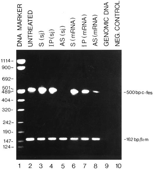 Fig. 1. Detection by RT-PCR of the c-fes mRNA in HL60 cells treated with c-fes ODN. Total cellular RNA was extracted after 5 days of c-fes AS ODN treatment as described in Materials and Methods. The 500-bp amplified c-fes fragment was obtained using the oligonucleotide primers hFES-DP (5′-ACTATGGGCTTCTCTTCCGAGCTG-3′ ) and hFES-RP (5′-TCACGGTCCTTGTCTTTGCTGGCCT-3′ ). The 162-bp human β2-microglobulin fragment, used as a quantitative control, was obtained using the oligonucleotide primers hβ2m-DP (5′-CTCGCGCTACTCTCTCTTTCT-3′ ) and hβ2m-RP (5′-TCCATTCTTCAGTAAGTCAACT-3′ ); Lane 1, DNA mol wt marker VIII (Boehringer); lane 2, untreated HL60 cells; lane 3, HL60 cells treated with the mixture of hFES-S-sj1 and 2; lane 4, HL60 cells treated with the mixture of hFES-IP-sj1 and 2; lane 5, HL60 cells treated with the mixture of hFES-AS-sj1 and 2; lane 6, HL60 cells treated with the mixture of hFES-S1, 2 and 3; lane 7, HL60 cells treated with a mixture of hFES-IP1, 2 and 3; lane 8, HL60 cells treated with hFES-AS1, 2 and 3; lane 9, negative control performed with HL60 cells genomic DNA; lane 10, negative control performed without the cDNA template.