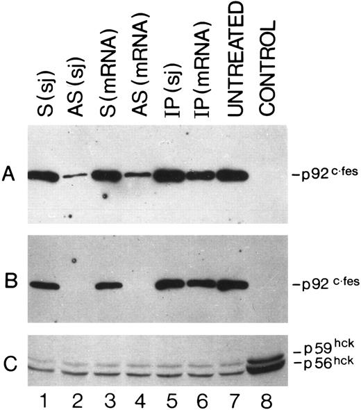 Fig. 3. Detection by Western blot analysis of p92c-fes protein in HL60 cells treated with c-fes ODN. p92c-fes was monitored in HL60 cells after 3 days (A) and 5 days (B) of c-fes ODN treatment, whereas the level of expression of hck protein was evaluated only after 5 days of treatment (C). Lane 1, HL60 cells treated with the mixture of hFES-S-sj1 and 2; lane 2, HL60 cells treated with the mixture of hFES-AS-sj1 and 2; lane 3, HL60 cells treated with the mixture of the hFES-S1, 2, and 3; lane 4, HL60 cells treated with the mixture of hFES-AS1, 2, and 3; lane 5, HL60 cells treated with the mixture of hFES-IP-sj1 and 2; lane 6, HL60 cells treated with the mixture of the hFES-IP1, 2, and 3; lane 7, ODN untreated HL60 cells; lane 8, negative control performed with K562 cells not expressing the p92c-fes (A and B); (C) shows the hck expression in HL60 cells treated with all-trans retinoic acid (positive control) as already described.8