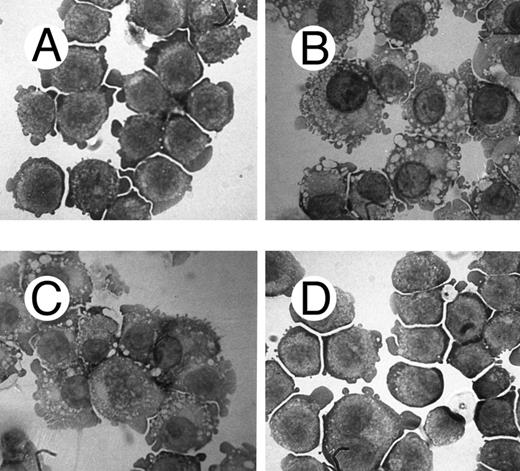 Fig. 7. Morphological characteristics of FDC-P1/MAC-11 cells treated with c-fes ODN before and after induction to macrophage differentiation by 48 hours of PMA treatment. (A) ODN untreated FDC-P1/MAC-11 cells; (B) ODN untreated FDC-P1/MAC-11 cells induced to macrophage differentiation with PMA; (C) macrophage morphology observed when FDC-P1/MAC-11 cells, pretreated for 5 days with the mFES-IP1, 2, and 3 ODN, are induced to differentiate with PMA; (D) morphology of FDC-P1/MAC-11 cells pretreated with mFES-AS1, 2, and 3 ODN and PMA induced. This panel is representative of the results obtained by several different experiments. Original magnification ×1,000.