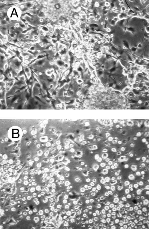 Fig. 8. Effects of c-fes AS ODN on the adhesion capacity of HL60 cells after 48 hours of PMA induction. Micrographs of HL60 cells treated with hFES-IP-sj1 and 2 (A) and treated with hFES-AS-sj1 and 2 (B). Original magnification ×200.