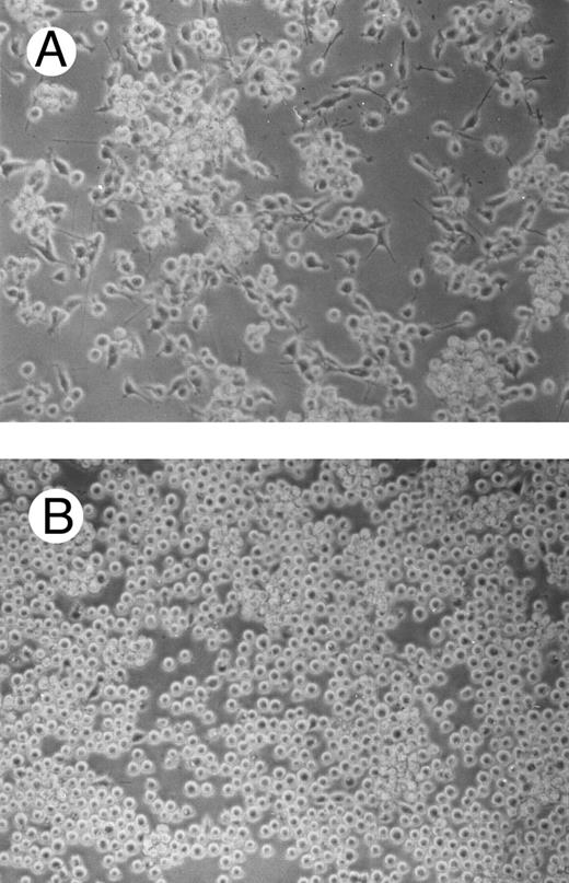 Fig. 9. Effects of c-fes AS ODN on the adhesion capacity of FDC-P1/MAC-11 cells after 48 hours of PMA induction. Micrographs of FDC-P1/MAC-11 cells treated with mFES-IP1, 2, and 3 (A) and treated with mFES-AS1, 2, and 3 (B). Original magnification ×200.