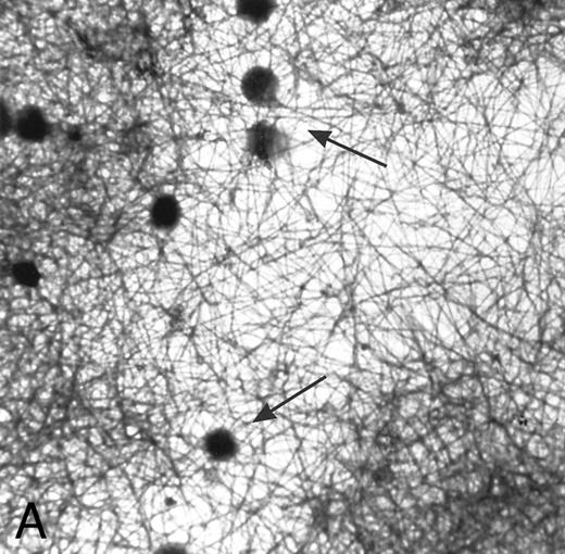 Fig. 1. (A) Fibrin network formed under static conditions (Fb-static). Tissue factor–rich ECM-coated coverslips were incubated with PPP in a 6-well plate (10 minutes at 37°C). Arrows indicate neutrophils that have adhered after a perfusion with purified resting neutrophils. (B) Fibrin network formed at low shear. ECM-coated cover slips were perfused with PPP from heparinized blood at shear stress 20 mPa (10 minutes at 37°C). (C) Fibrin network formed at high shear stress. ECM-coated cover slips were perfused with PPP from heparinized blood at a shear stress of 80 mPa (10 minutes at 37°C). (D) Fibrin network with platelets (Fb + platelets). ECM-coated cover slips were perfused twice: first with PPP from heparinized blood at a shear stress of 20 mPa (10 minutes at 37°C), followed by perfusion with citrated whole blood for 7 minutes at a shear rate of 1,600 s−1 (ie, a shear stress of ∼7 Pa). As a result, platelets covered 30% to 40% of the fibrin network (arrows).