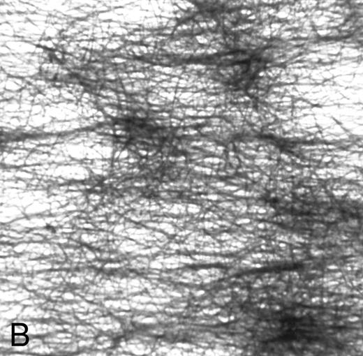Fig. 1. (A) Fibrin network formed under static conditions (Fb-static). Tissue factor–rich ECM-coated coverslips were incubated with PPP in a 6-well plate (10 minutes at 37°C). Arrows indicate neutrophils that have adhered after a perfusion with purified resting neutrophils. (B) Fibrin network formed at low shear. ECM-coated cover slips were perfused with PPP from heparinized blood at shear stress 20 mPa (10 minutes at 37°C). (C) Fibrin network formed at high shear stress. ECM-coated cover slips were perfused with PPP from heparinized blood at a shear stress of 80 mPa (10 minutes at 37°C). (D) Fibrin network with platelets (Fb + platelets). ECM-coated cover slips were perfused twice: first with PPP from heparinized blood at a shear stress of 20 mPa (10 minutes at 37°C), followed by perfusion with citrated whole blood for 7 minutes at a shear rate of 1,600 s−1 (ie, a shear stress of ∼7 Pa). As a result, platelets covered 30% to 40% of the fibrin network (arrows).