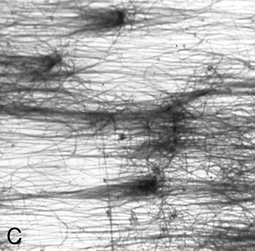 Fig. 1. (A) Fibrin network formed under static conditions (Fb-static). Tissue factor–rich ECM-coated coverslips were incubated with PPP in a 6-well plate (10 minutes at 37°C). Arrows indicate neutrophils that have adhered after a perfusion with purified resting neutrophils. (B) Fibrin network formed at low shear. ECM-coated cover slips were perfused with PPP from heparinized blood at shear stress 20 mPa (10 minutes at 37°C). (C) Fibrin network formed at high shear stress. ECM-coated cover slips were perfused with PPP from heparinized blood at a shear stress of 80 mPa (10 minutes at 37°C). (D) Fibrin network with platelets (Fb + platelets). ECM-coated cover slips were perfused twice: first with PPP from heparinized blood at a shear stress of 20 mPa (10 minutes at 37°C), followed by perfusion with citrated whole blood for 7 minutes at a shear rate of 1,600 s−1 (ie, a shear stress of ∼7 Pa). As a result, platelets covered 30% to 40% of the fibrin network (arrows).