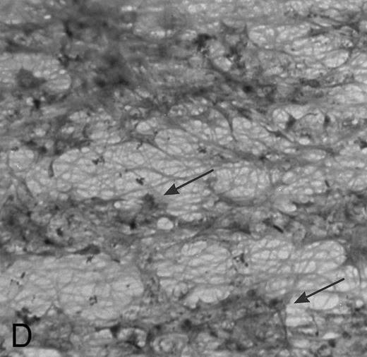 Fig. 1. (A) Fibrin network formed under static conditions (Fb-static). Tissue factor–rich ECM-coated coverslips were incubated with PPP in a 6-well plate (10 minutes at 37°C). Arrows indicate neutrophils that have adhered after a perfusion with purified resting neutrophils. (B) Fibrin network formed at low shear. ECM-coated cover slips were perfused with PPP from heparinized blood at shear stress 20 mPa (10 minutes at 37°C). (C) Fibrin network formed at high shear stress. ECM-coated cover slips were perfused with PPP from heparinized blood at a shear stress of 80 mPa (10 minutes at 37°C). (D) Fibrin network with platelets (Fb + platelets). ECM-coated cover slips were perfused twice: first with PPP from heparinized blood at a shear stress of 20 mPa (10 minutes at 37°C), followed by perfusion with citrated whole blood for 7 minutes at a shear rate of 1,600 s−1 (ie, a shear stress of ∼7 Pa). As a result, platelets covered 30% to 40% of the fibrin network (arrows).