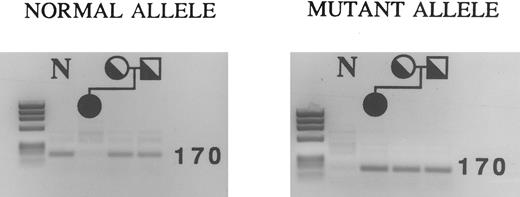 Fig. 1. ASPCR analysis showing the mutation at nucleotide −61 in the proband and her parents. PCR fragments spanning nucleotides −416 to +98 were first generated from genomic DNA, and then used as templates in ASPCR. A sense primer with the normal or mutant sequence at its 3′ end was used with a common antisense primer to generate a fragment of 170 bp. Using primers for the normal allele, fragments of the correct size were amplified in both parents, but not in the patient (left). Using primers for the mutant allele, fragments of the correct size were amplified in all family members (right). The result with a normal control (N) are shown in the first lane of each gel. The DNA mol wt markers are a HaeIII digest of φX174.