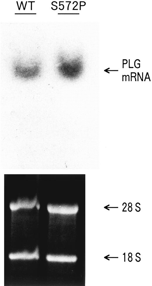 Fig. 6. Northern blot analysis of transfected COS-1 cells. COS-1 cells were transiently transfected with pTH3/WT (WT) or pTH3/S572P (S572P) plasmid. Equal amounts of total RNA isolated from the transfected COS-1 cells were loaded in each lane, as shown by ethidium bromide staining (lower panel). The PLG mRNA was hybridized with a 32P-labeled full-length PLG cDNA probe (upper panel).