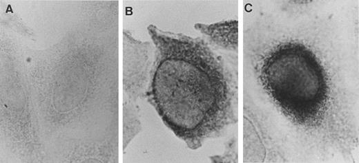 Fig. 7. Immunolocalization of rPLG in stable transfectants. Untransfected CHO-K1 cells (A) and stably transfected CHO-K1 cells expressing rR561S (B) or rR561S + S572P (C) were fixed, permeabilized, and reacted with rabbit polyclonal anti-human PLG antibody. The cells then were incubated with biotinylated anti-rabbit IgG and immunostained using an ABC kit.