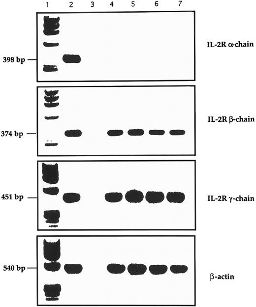 Fig. 7. RT-PCR analysis of the expression of IL-2R and control β-actin in GL from 4 LDGL patients. Lane 1, molecular weight marker (φl74 Hae-digested); lane 2, control PBMC stimulated for 12 hours with PHA (5 μg/mL); lane 3, negative control (sample without cDNA); lanes 4 and 5, 2 CD3+ LDGL cases (cases no. 3 and 5 in Table 1); lanes 6 and 7, 2 CD3− LDGL (cases no. 10 and 11 in Table 1).