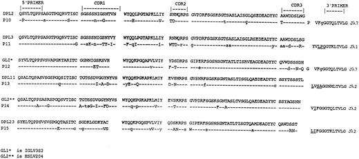 Fig. 3. Deduced amino acid sequences of the Vλ regions of the tumor-derived clones from patients with myeloma. Comparisons are made with the closest germline Vλ genes. Uppercase, replacement mutations; lowercase, silent mutations. Replacement mutations in Jλ are underlined.