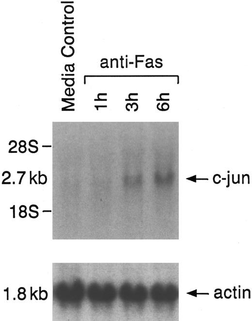 Fig. 2. Effect of anti-Fas MoAb on induction of early response gene c-jun in RPMI 8226 MM cells. Cells were either cultured in media alone or treated with anti-Fas MoAb for the indicated times. Total cellular RNA (20 μg/lane) was hybridized to 32P-labeled c-jun and actin probes.