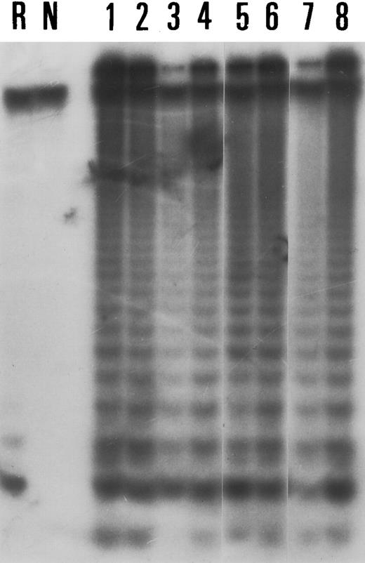 Fig. 1. Results of the TRAP assay in four lymphoma cell lines (Lanes 1 through 4: Val, Deglis, Rec-1, BL9); four lymphoblastoid cell lines (lanes 5 through 8: Bever, maco, Ceb, Oru). Lane R corresponds to RNase A pretreated sample from the Val cell line and lane N corresponds to a negative control (without CHAPS extracts).
