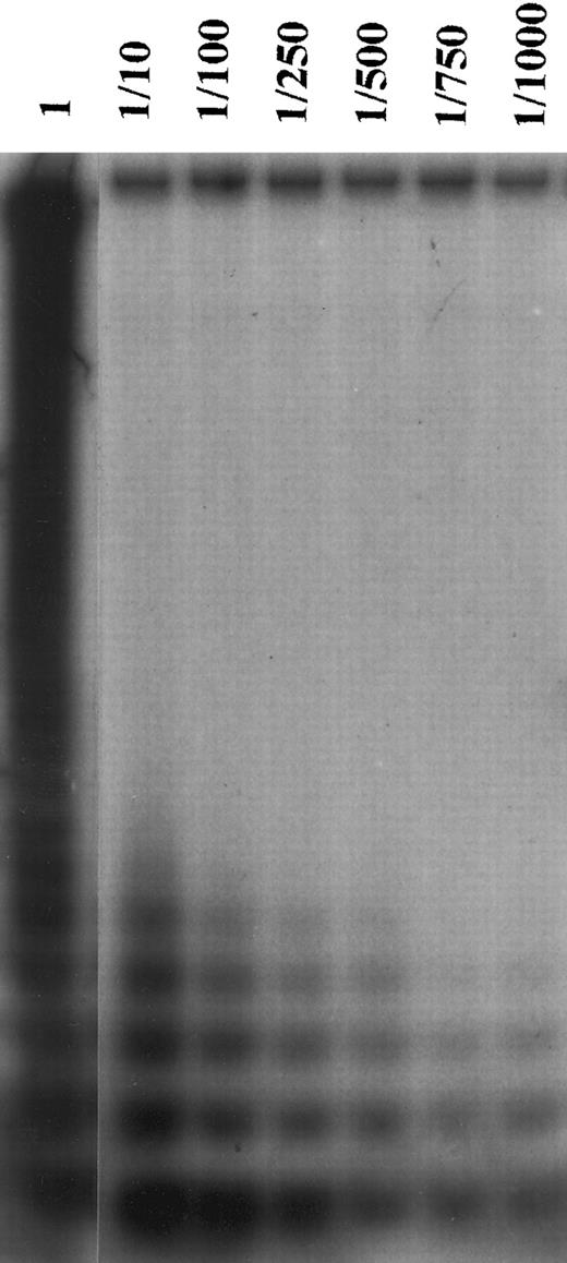 Fig. 5. Results of the TRAP assay in a telomerase-negative case of HD after serial dilutions of protein extracts from the Val lymphoma cell line. Line 1 corresponds to 6 μg of protein extracts from the Val cell line. Note that after serial dilutions the signal is still present at the dilution 1/1,000.