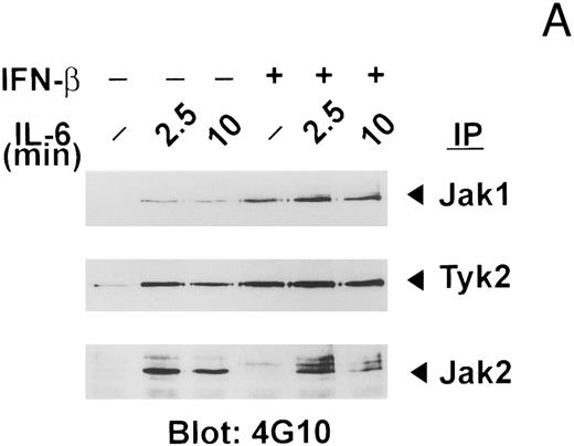Fig. 4. IFN-β pretreatment attenuates IL-6–induced tyrosine phosphorylation of Jak2. (A) Whole-cell extracts were prepared from serum-deprived (14 hours) U266 cells pretreated with IFN-β (500 U/mL) for 50 minutes and then exposed to IL-6 (25 ng/mL) for the times indicated. Jak2, Jak1, and Tyk2 were sequentially immunoprecipitated from the same extracts and subjected to immunoblotting with an anti-pTyr MoAb. (B) The blot shown for Jak2 in (A) was stripped and reprobed with the immunoprecipitating MoAb to Jak2 to demonstrate equal loading and that the higher molecular mass bands detected with the anti-pTyr MoAb were not cross-reacting proteins recognized by the anti-Jak2 MoAb. The Jak/Tyk-specific bands are denoted by arrows. Representative of three separate experiments.