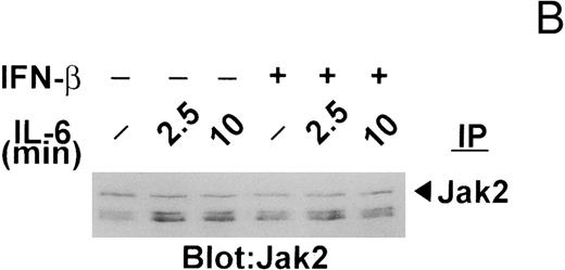 Fig. 4. IFN-β pretreatment attenuates IL-6–induced tyrosine phosphorylation of Jak2. (A) Whole-cell extracts were prepared from serum-deprived (14 hours) U266 cells pretreated with IFN-β (500 U/mL) for 50 minutes and then exposed to IL-6 (25 ng/mL) for the times indicated. Jak2, Jak1, and Tyk2 were sequentially immunoprecipitated from the same extracts and subjected to immunoblotting with an anti-pTyr MoAb. (B) The blot shown for Jak2 in (A) was stripped and reprobed with the immunoprecipitating MoAb to Jak2 to demonstrate equal loading and that the higher molecular mass bands detected with the anti-pTyr MoAb were not cross-reacting proteins recognized by the anti-Jak2 MoAb. The Jak/Tyk-specific bands are denoted by arrows. Representative of three separate experiments.