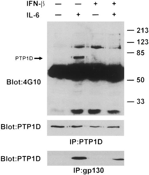 Fig. 6. IFN-β downregulates IL-6–induced PTP1D/Syp tyrosine phosphorylation and association with gp130. PTP1D/Syp was immunoprecipitated from lysates of IFN-β and IL-6–treated U266 cells (1 × 107) followed by immunoblotting with both anti-pTyr (top panel) and anti-PTP1D/Syp (middle panel) specific MoAbs. The lower panel shows samples (1.5 × 107 cells) immunoprecipitated with gp130 followed by probing with anti-PTP1D/Syp specific MoAb. Arrow indicates the position of PTP1D/Syp.