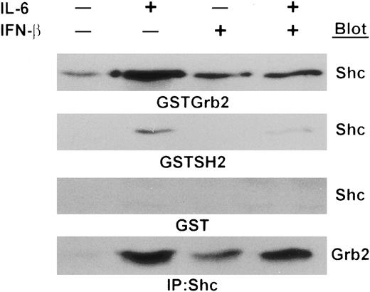 Fig. 8. IFN-β and IL-6 influence the interaction of Shc proteins with Grb2. Extracts prepared from IL-6 and IFN-β stimulated U266 cells were used for either GST-fusion protein interaction studies (top three panels) or immunoprecipitation with anti-Shc antibodies (bottom panel). In all cases lysates were incubated with the specified fusion proteins or antibodies for 2 hours at 4°C and associated proteins detected by immunoblotting with either anti-Shc (in the case of Grb2 fusion protein interaction studies) or anti-Grb2 MoAbs (in the case of Shc immunoprecipitations).
