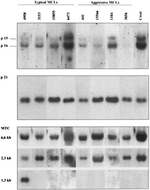 Fig. 1. Southern blot analysis of four typical and four aggressive mantle cell lymphomas. HindIII-digested DNA was electrophoresed on a 0.8% agarose gel, transferred to a nylon membrane, and hybridized with the exon 2 of p16INK4a, p21Waf1, and bcl-1 MTC probes. The aggressive MCL 3858 and 15566 show homozygous deletions of p16INK4a and p15INK4b genes. No alterations in the p21Waf1 signal was seen in any of the cases. Case 4958 had a bcl-1 rearrangement detected with HindIII. Case 441 also had a bcl-1 rearrangement detected with EcoRI and BamHI but not with HindIII. No rearrangements were detected in the remaining cases.