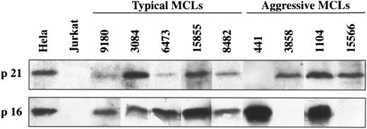 Fig. 3. Western blot analysis of p21Waf1 and p16INK4a in typical and aggressive mantle cell lymphomas. The aggressive MCL 441 shows a loss of p21Waf1 protein expression whereas MCL 3858 and 15566 have a loss of p16INK4a protein expression. These genes are constantly expressed in the typical variants of MCLs.