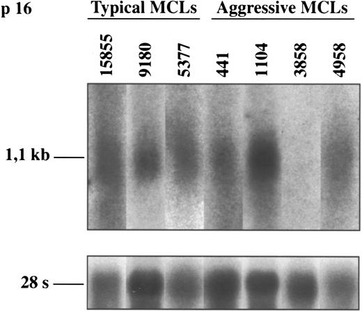 Fig. 4. Northern blot analysis of p16INK4a in typical and aggressive mantle cell lymphomas. The aggressive MCL 3858 shows a loss of p16INK4a mRNA expression. This finding is concordant with the lack of protein expression and the homozygous deletion of the gene in this case (shown in Figs 1 and 3, respectively). The blots were stripped of the p16INK4a probe and rehybridized with the 28S probe as a loading control.