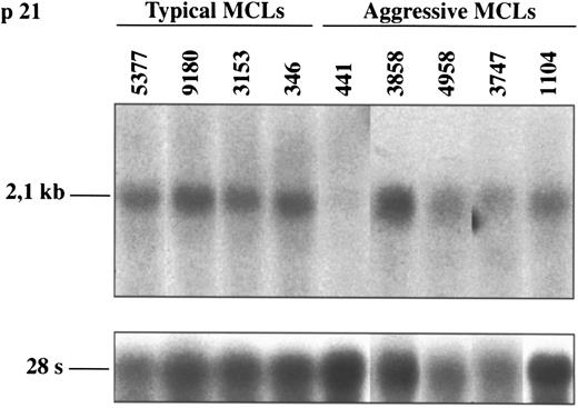 Fig. 5. Northern blot analysis of p21Waf1 in typical and aggressive mantle cell lymphomas. The aggressive MCL 441 shows a loss of p21Waf1 mRNA expression. This finding is concordant with the lack of protein expression in this case (shown in Fig 3). The blots were stripped of the p16INK4a probe and rehybridized with the 28S probe as a loading control.
