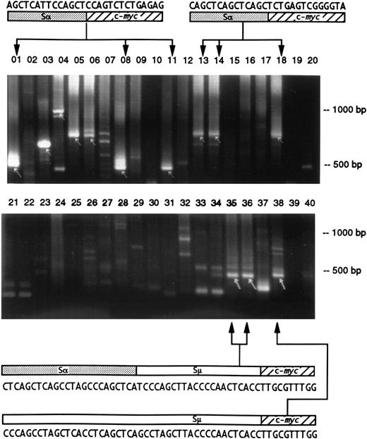 Fig. 1. Detection of Ig/c-myc recombinations in different regions of the intestine in two BALB/cAn mice. The gut was sectioned into 10 fragments and the DNA preparations were analyzed by duplicate PCR amplifications and electrophoresed on 2% agarose gels. The presence of Ig/c-myc recombinations are indicated by arrows. The upper gel shows samples from a mouse 7 days after pristane treatment; identical products were obtained in lanes 01 (duodenum), 08 (proximal ileum), and 11 (middle ileum) and in 13, 14 (middle ileum), and 18 (distal ileum) indicating a common origin of these cells. In the second, untreated mouse (lower gel), clones from distal (lanes 35 and 36) and terminal ileum (lane 38) are related by virtue of their identical Igμ/c-myc recombination sequence. The upper sequence shows 24 bp of switchα (GenBank “MUSIALPHA” #2293-2270) followed by switchμ (“MUSIGCD07” #5550-5529) and c-myc. In the lower recombination, the same 18 bp of switchμ is preceded by a sequence that has a switchμ-typical pattern of pentamers, but that could not be aligned to germline. It originates most likely from the part of switchμ that has not yet been sequenced. The two recombinations indicate that the Igμ/c-myc rearrangement was followed by additional recombinations.